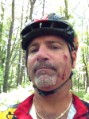 MTB Willowdale - Birthday Boy is attacked by a bridge